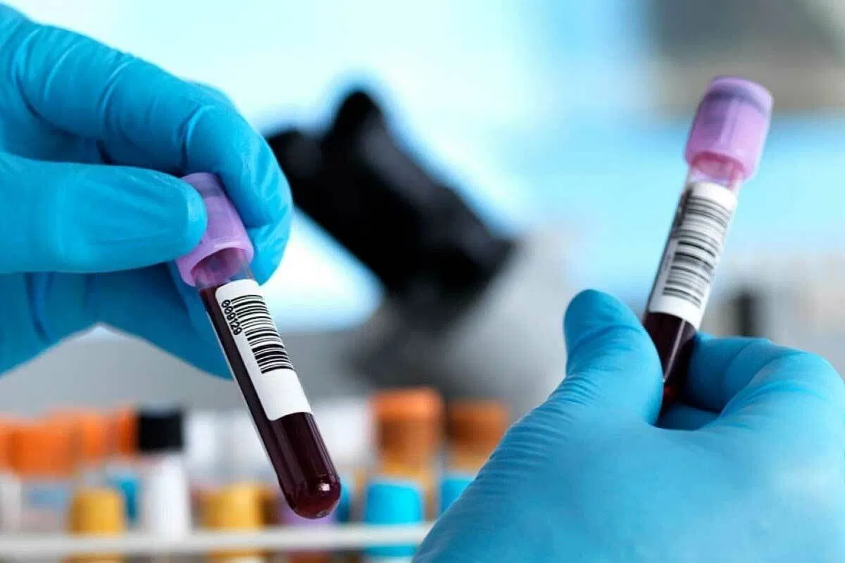 Premedi bloedonderzoek laboratorium